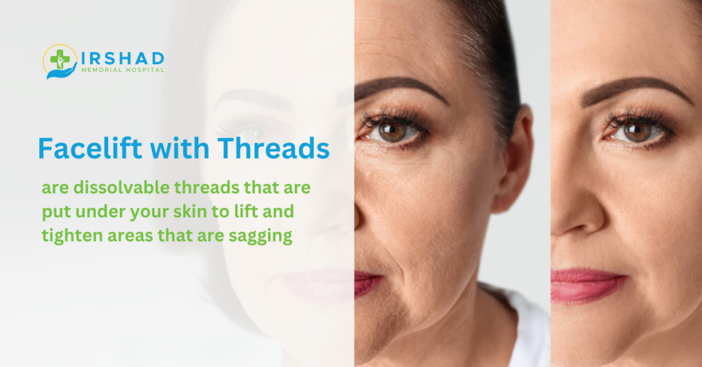 Facelift for Threads