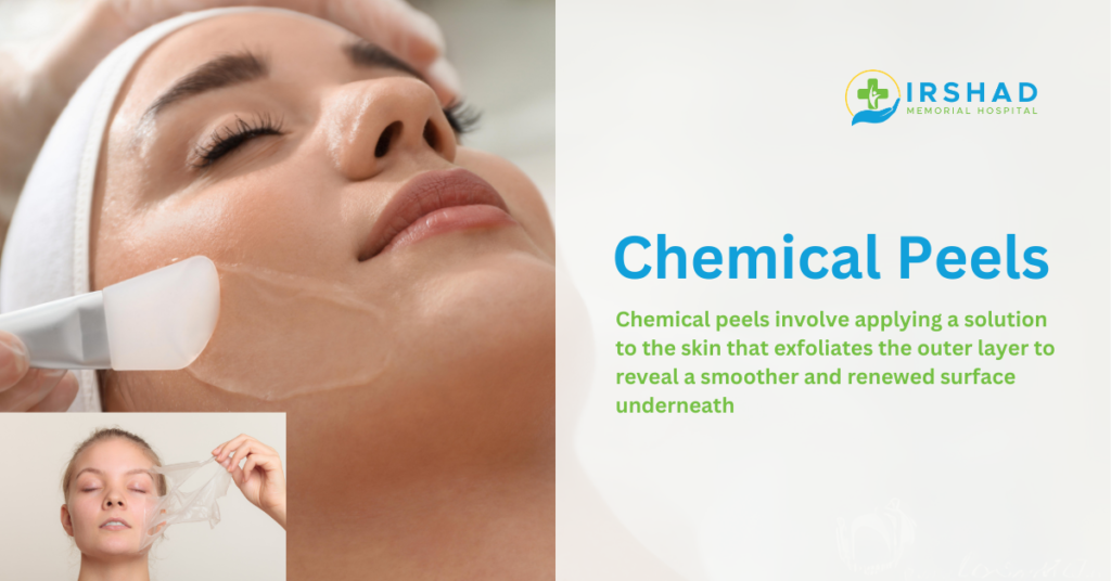 Chemical Peels